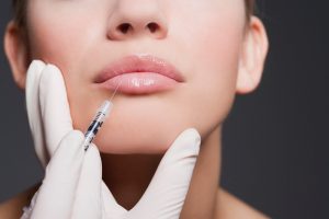 Baytree Aesthetics Prestatyn Filler treatments